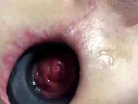 Anal gaping anal prolapsing anal vacuum pumping compilation