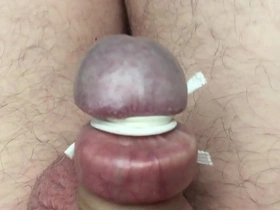 Stretched foreskin and tied glands.